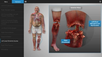 Digital Injury Summary