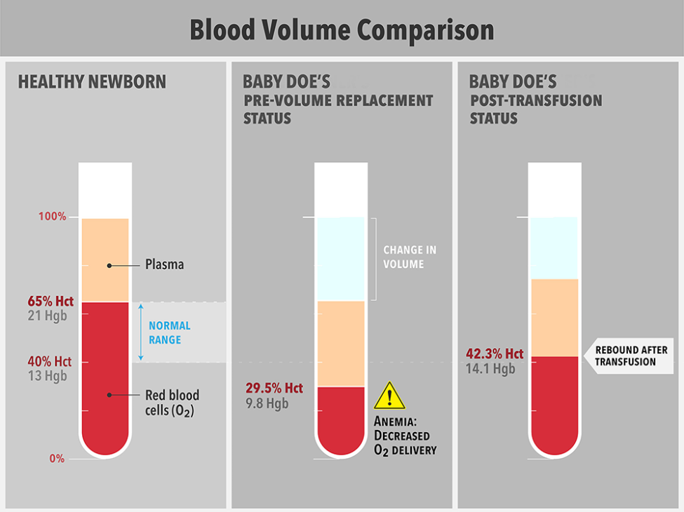 Using Visual Data to Compare & Contrast the Evidence in Your Cases