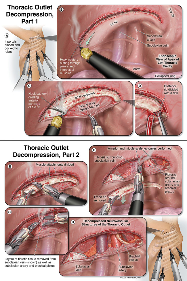 MediVisuals + High Impact Wins Two Awards At This Year’s Association of Medical Illustrators Salon