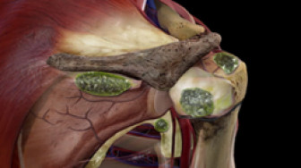 Medical Malpractice Animation