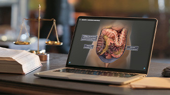 $8.2 Million Verdict: Missed Diagnosis Leads to Mesenteric Ischemia