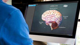 Exhibits Detail Injuries in Medical Malpractice Case, Resulting in a $13.6M Verdict