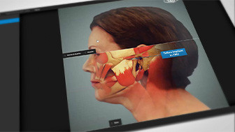 When Do You Need Trial Graphics to Enhance Your Case?