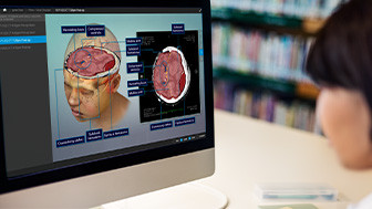 $30,100,000 Settlement: Teenager Suffers Catastrophic Brain Injury in School Crosswalk Collision