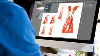 $18M Verdict: Illustrating Severe Injuries and Surgeries Following Fall in Parking Lot