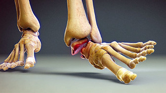 Why Choosing the Right Legal Animation Studio Is Vital for Your Personal Injury Cases