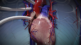 The Importance of Clear Trial Graphics in Medical Misdiagnosis Cases