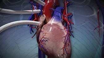 The Importance of Clear Trial Graphics in Medical Misdiagnosis Cases