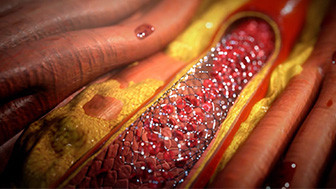 How Trial Graphics Can Help to Support Medical Malpractice Cases