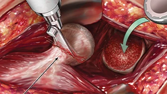 How Medical Legal Illustrations Aid Cases