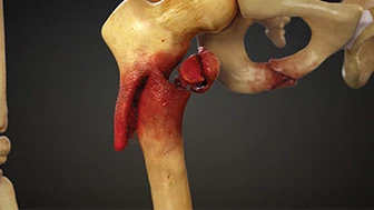 The Role a Legal Graphic Service Can Play in Complex Personal Injury Lawsuits