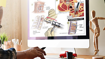 How High-Quality Medical Legal Illustrations Can Help Jurors to Understand Complex Concepts