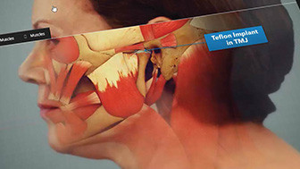 Importance of Medical Legal Illustrations in Trials