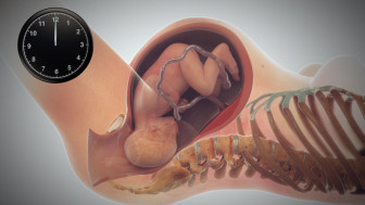 Normal Unassisted Birth