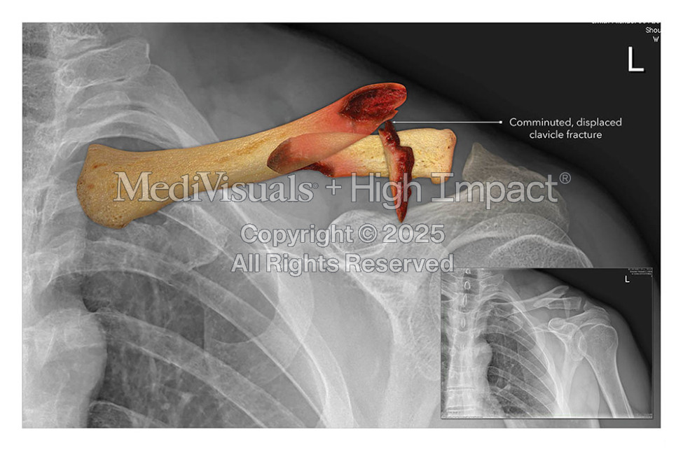 Hottman Law Office: An Exciting Partnership