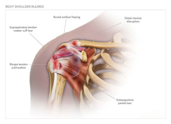 Right Shoulder Injuries