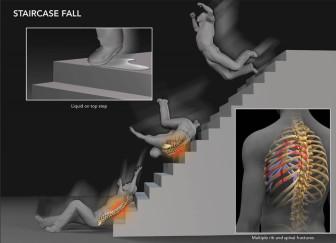 Staircase Fall