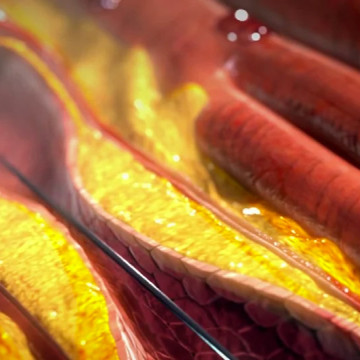 $21.3M Verdict Exposing KY Malpractice Monopoly at the Heart of Cardiologists’ Conspiracy