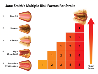 Stroke Risk Factors