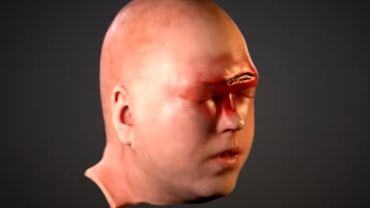 Summary of Facial and Skull Injuries