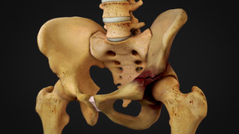 Summary of Hip Injuries