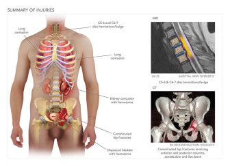 Summary of Injuries