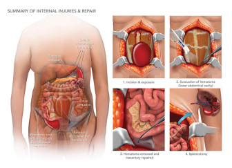 Summary of Internal Injuries and Repair