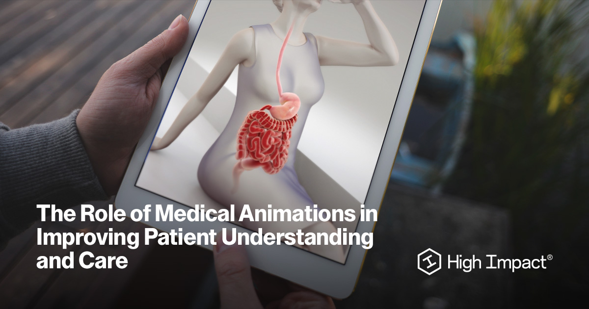 How Medical Animations Boost Patient Understanding | High Impact, LLC